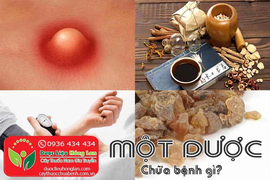 MOT-DUOC-CHUA-BENH-GI-CTY-DUOC-LIEU-HONG-LAN