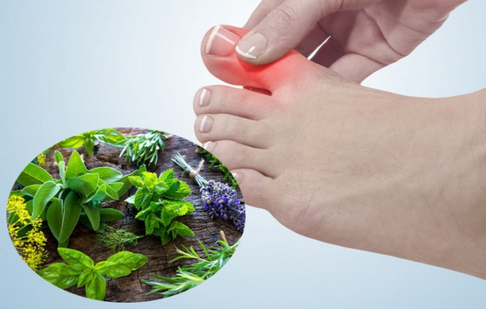 Những bài thuốc chữa bệnh Gút (Gout) hiệu quả theo dân gian